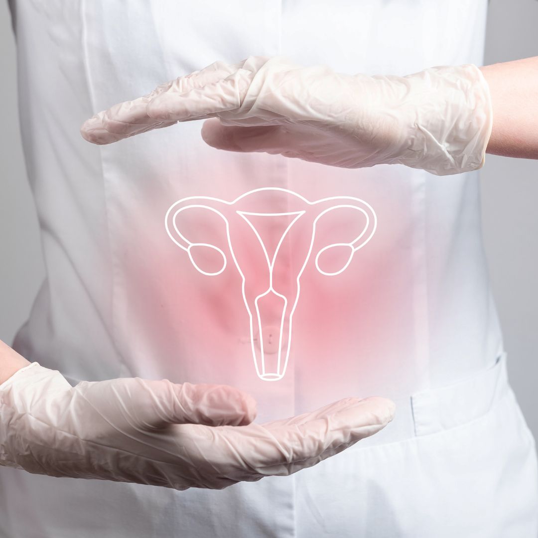 Razumijevanje endometrioze